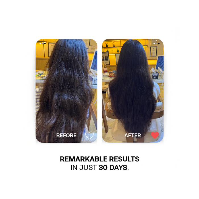 30 Days Hair Growth Trio - Deal of The Year - Avail Flat 25% Off